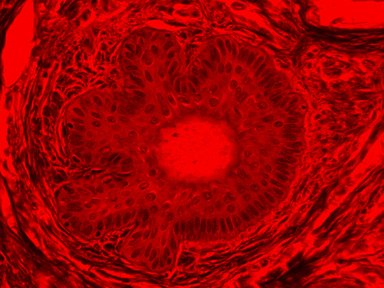 Brightfield Image of Dermal Tissue filtered with Red