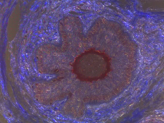 Darkfield Imaging of Dermal Tissue